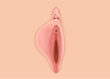 비대칭 소음순